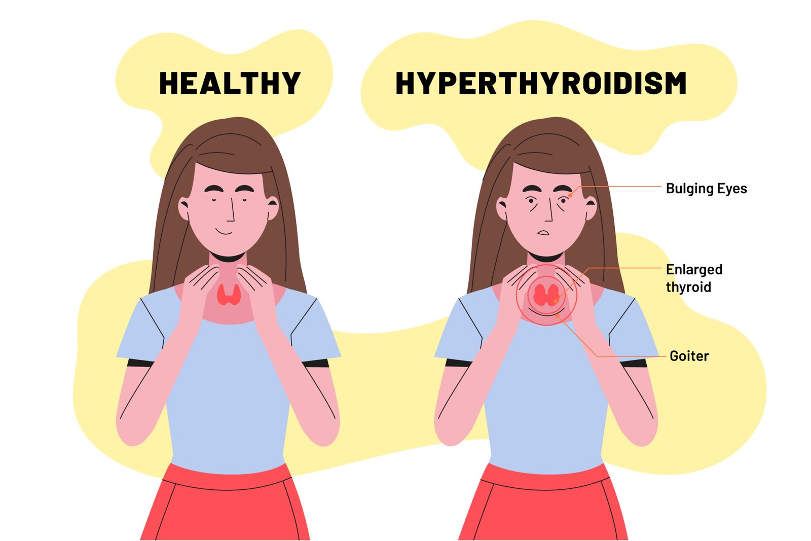hyperthyroid
